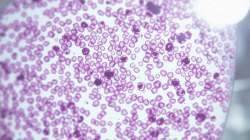 Jakie zmiany cytologiczne są związane z zapaleniem?